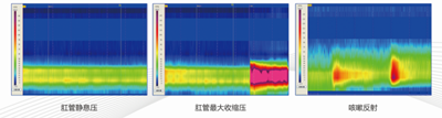 5fa600dea83e5.png